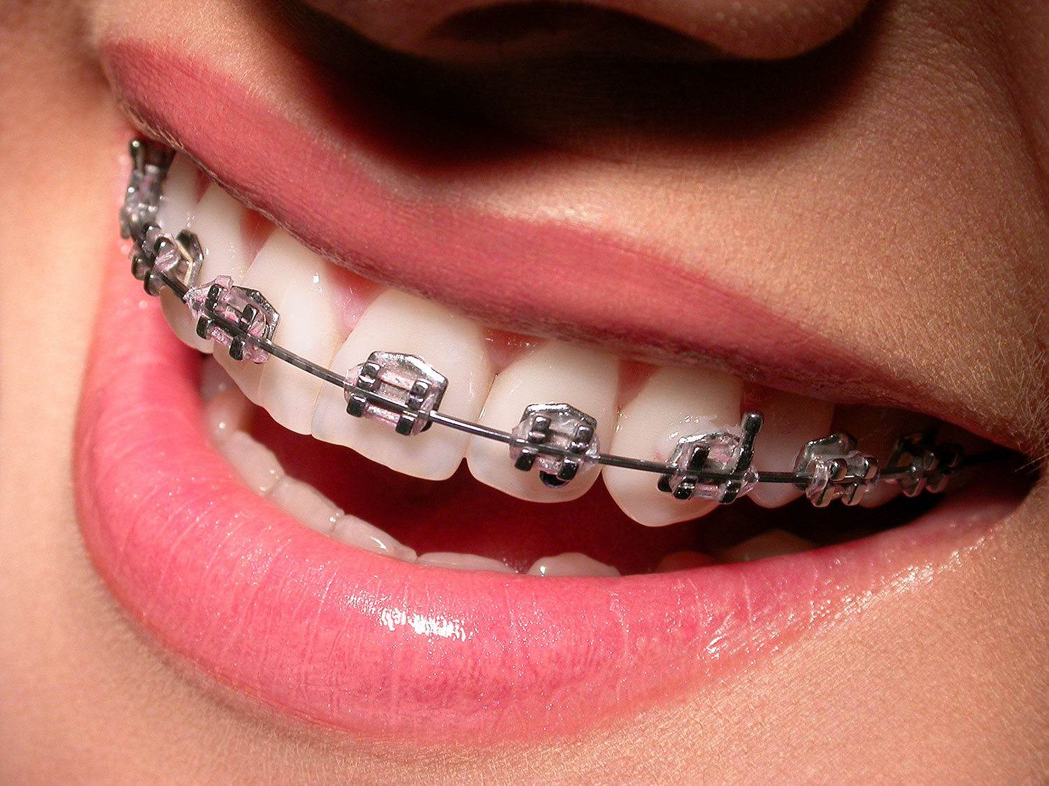 orthodontics.jpg